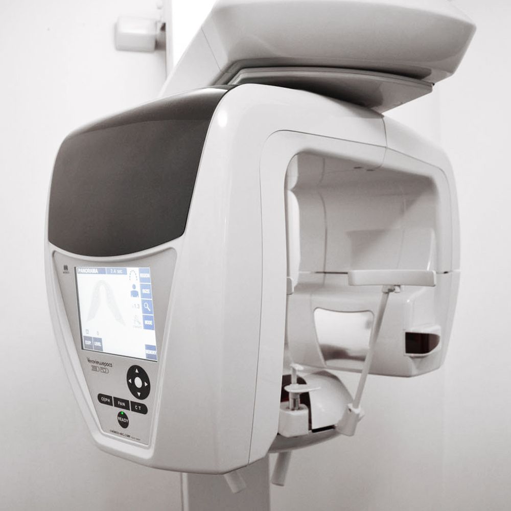 CBCT - 3D Imaging allows us to better examine teeth before the treatment